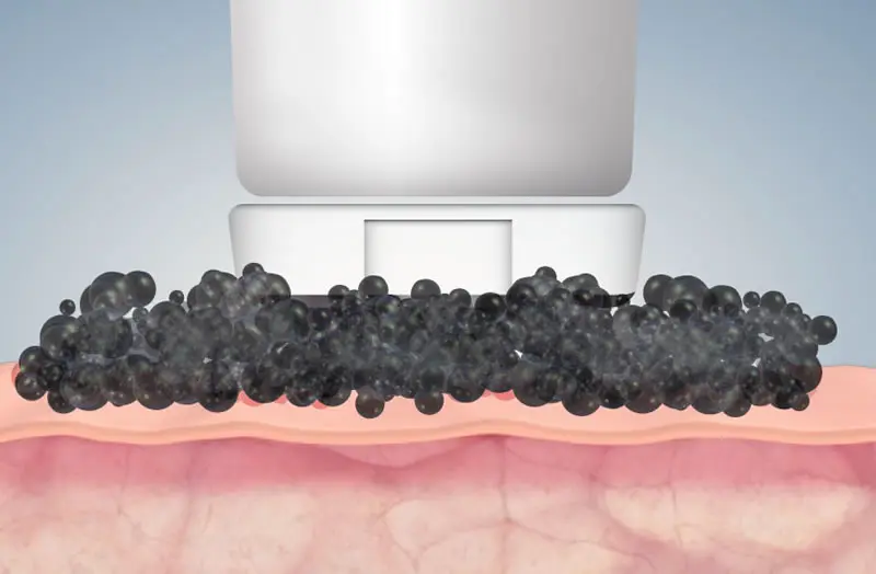 Micro vibración